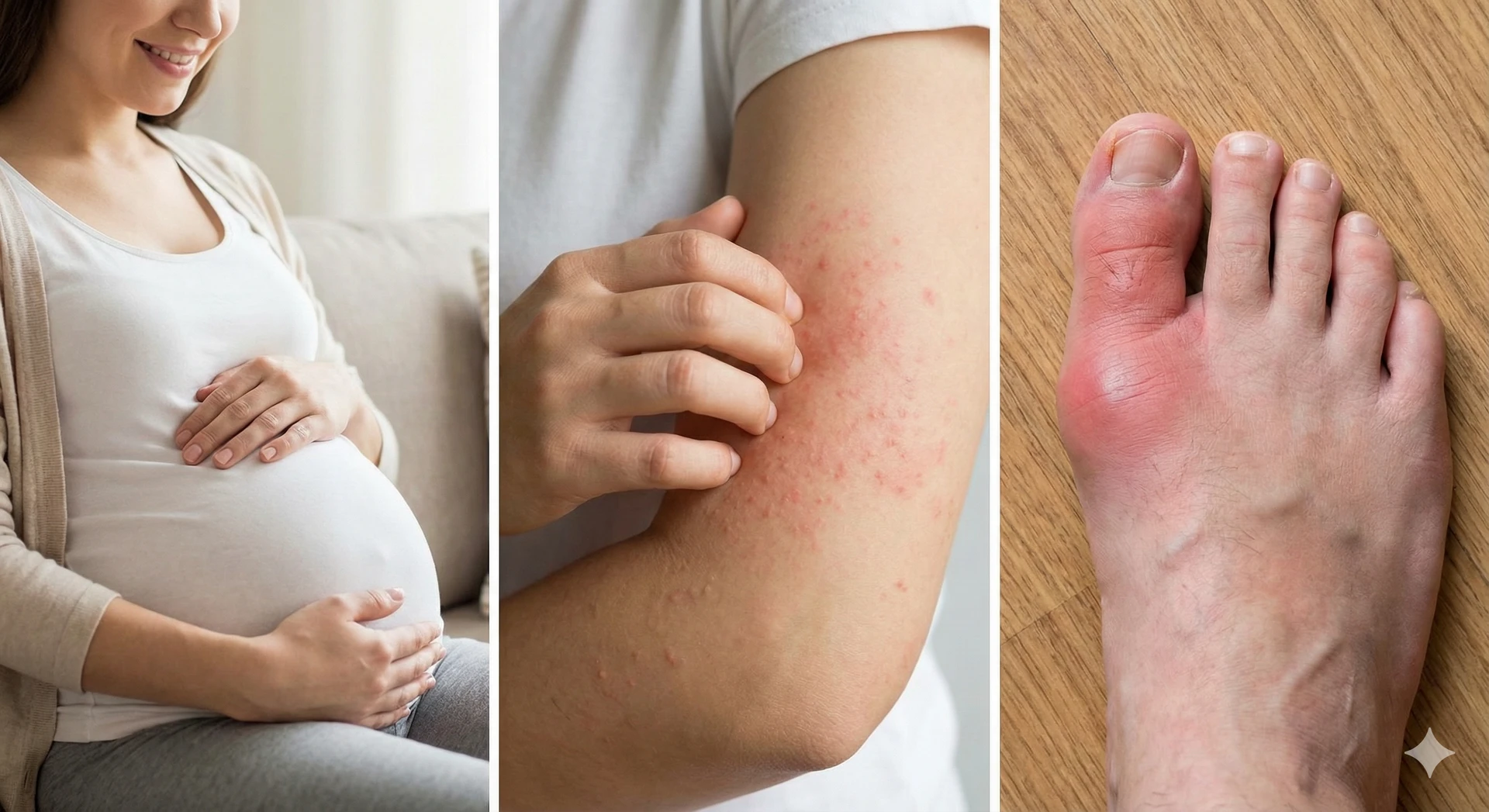 Một phụ nữ mang thai, một người bị dị ứng và một người bị bệnh gout, tượng trưng cho những đối tượng nên cẩn trọng khi ăn cua